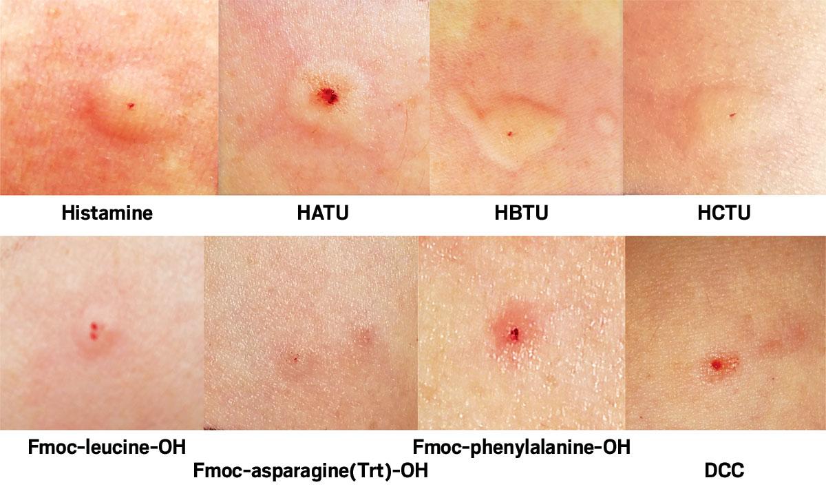 Navigating ⁢Reactions: What to Do if Allergies Occur
