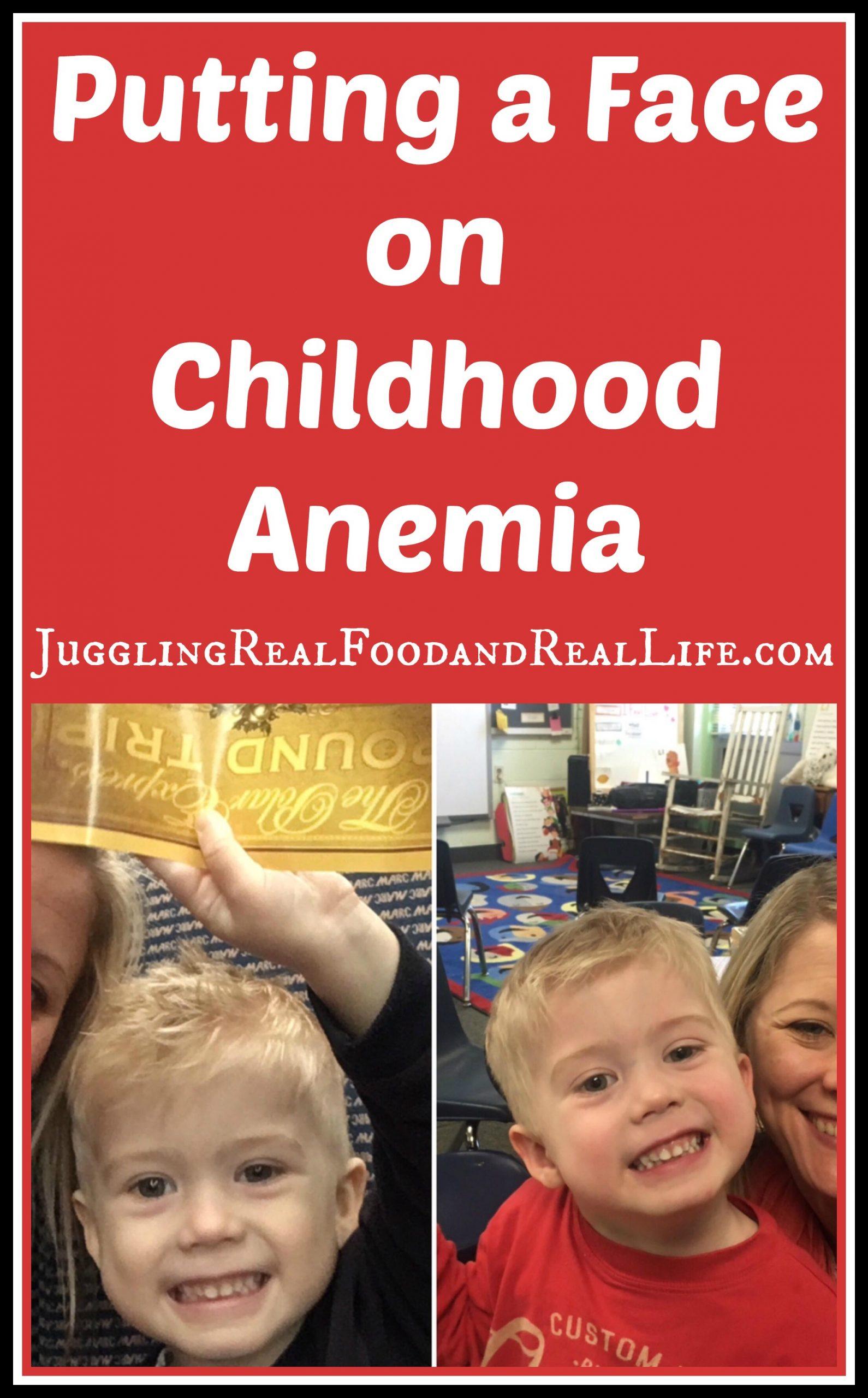 Understanding Toddler Anemia and the Need for Iron-Fortified Formulas