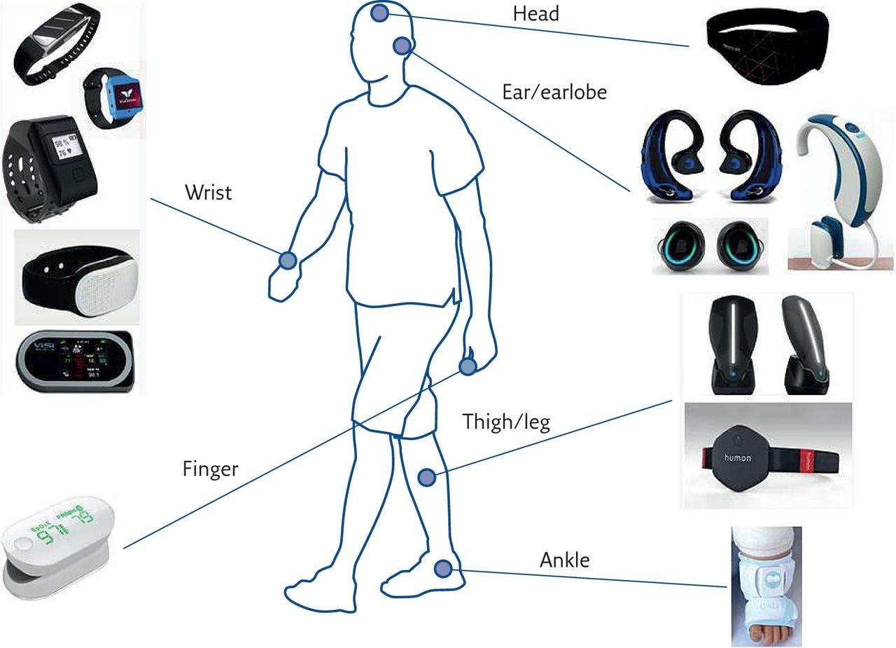 The Role of Smart Wearables in Early Detection of Cardiovascular Diseases